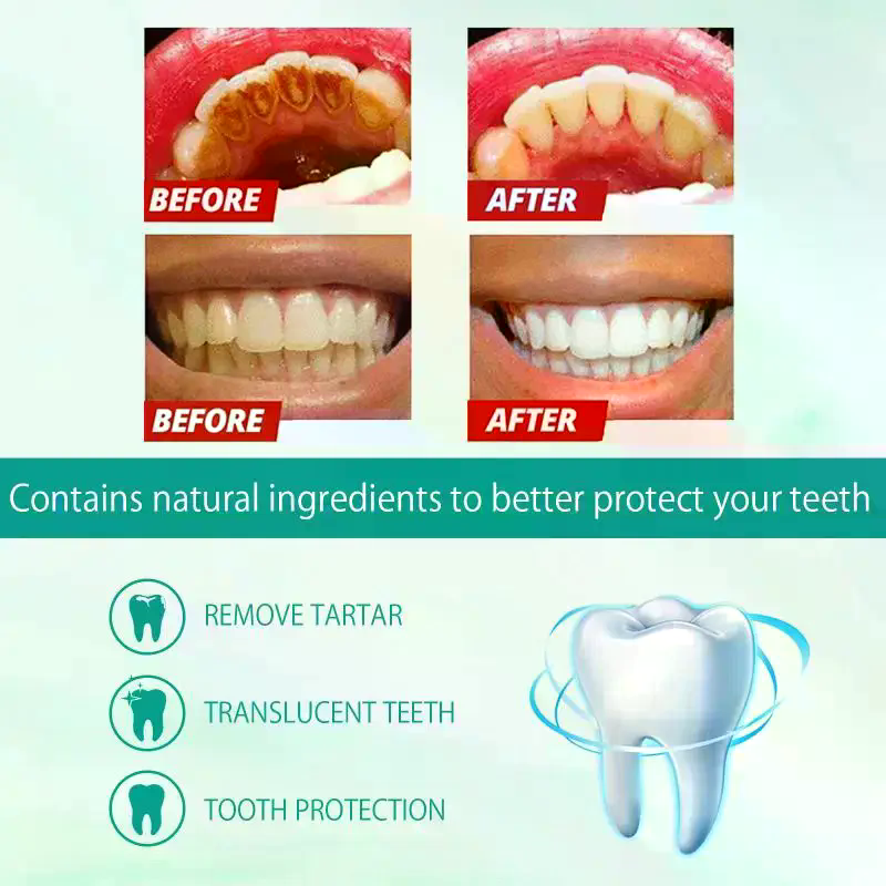 Teeth Whitening Foam Toothpaste - Whitening Foam Toothpaste Cleansing Prevent Cavities