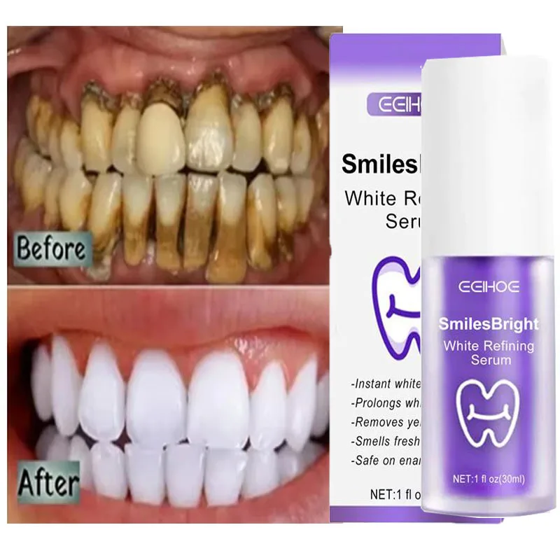Teeth Whitening Korea - Whitening Toothpaste Teeth Cleansing Whiten Gel