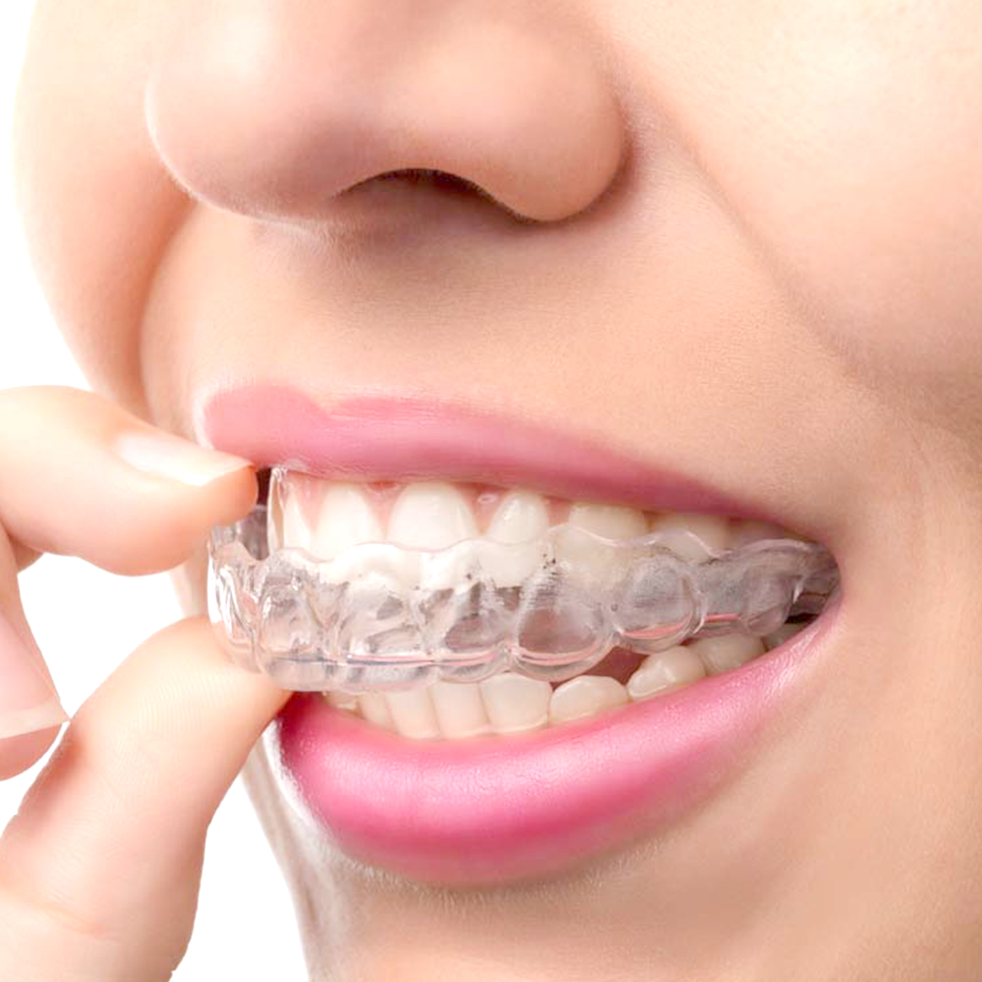 1Pc/2Pcs Transparent Teeth Tra - огляд і ціна Teeth Whitening For Trays