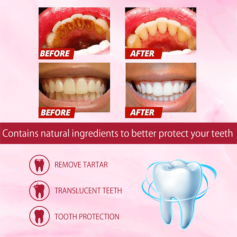 SP-4 Probiotic Whitening Tooth - огляд і ціна Teeth Whitening Enzymes