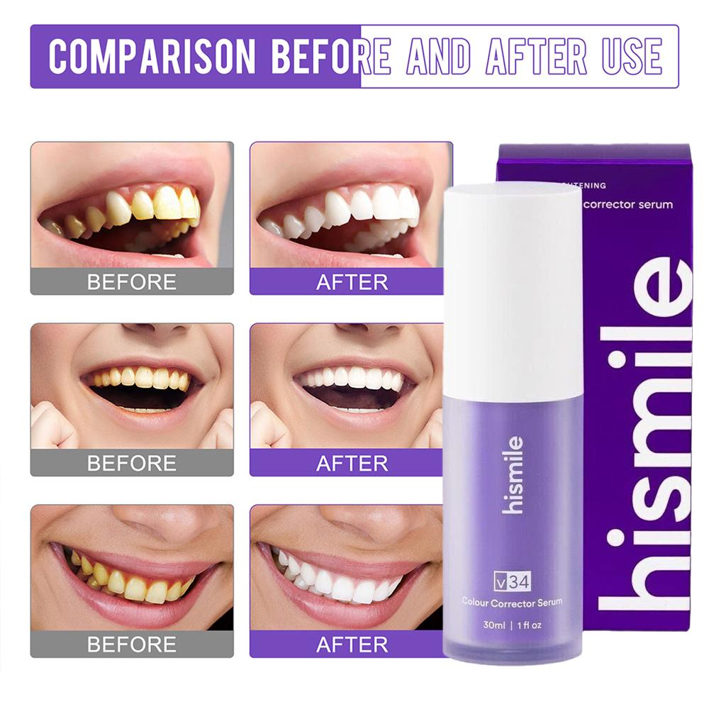 30ml Hismile V34 Purple Teeth  - огляд і ціна Teeth Whitening Foam Toothpaste