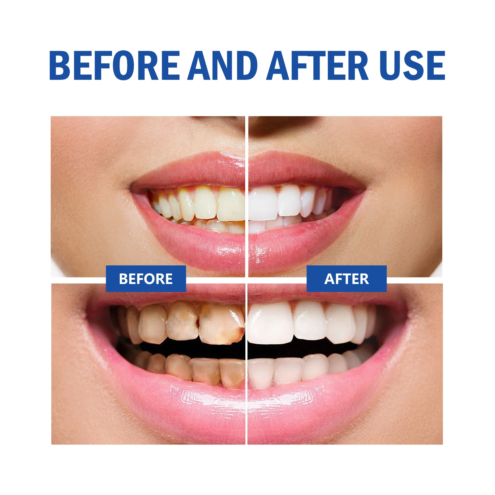 2pcs Gum Repair Gel Spray Deep - огляд і ціна Teeth Whitening Xylitol Gum