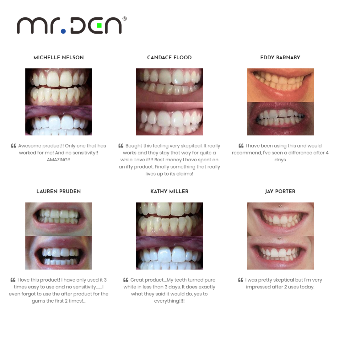 Dr. Whiten 3 Pack Teeth Whiten - огляд і ціна Teeth Whitening Gel