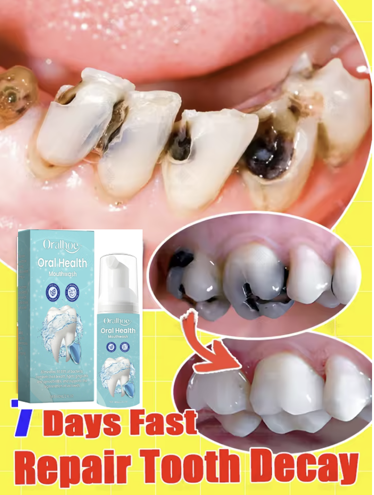 Oralhoe 60ml Teeth Cleaning Mo - огляд і ціна Teeth Whitening Foam Toothpaste