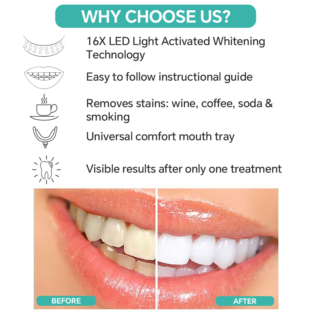 Teeth Whitening Enhancer Light - огляд і ціна Led Mouth Tray