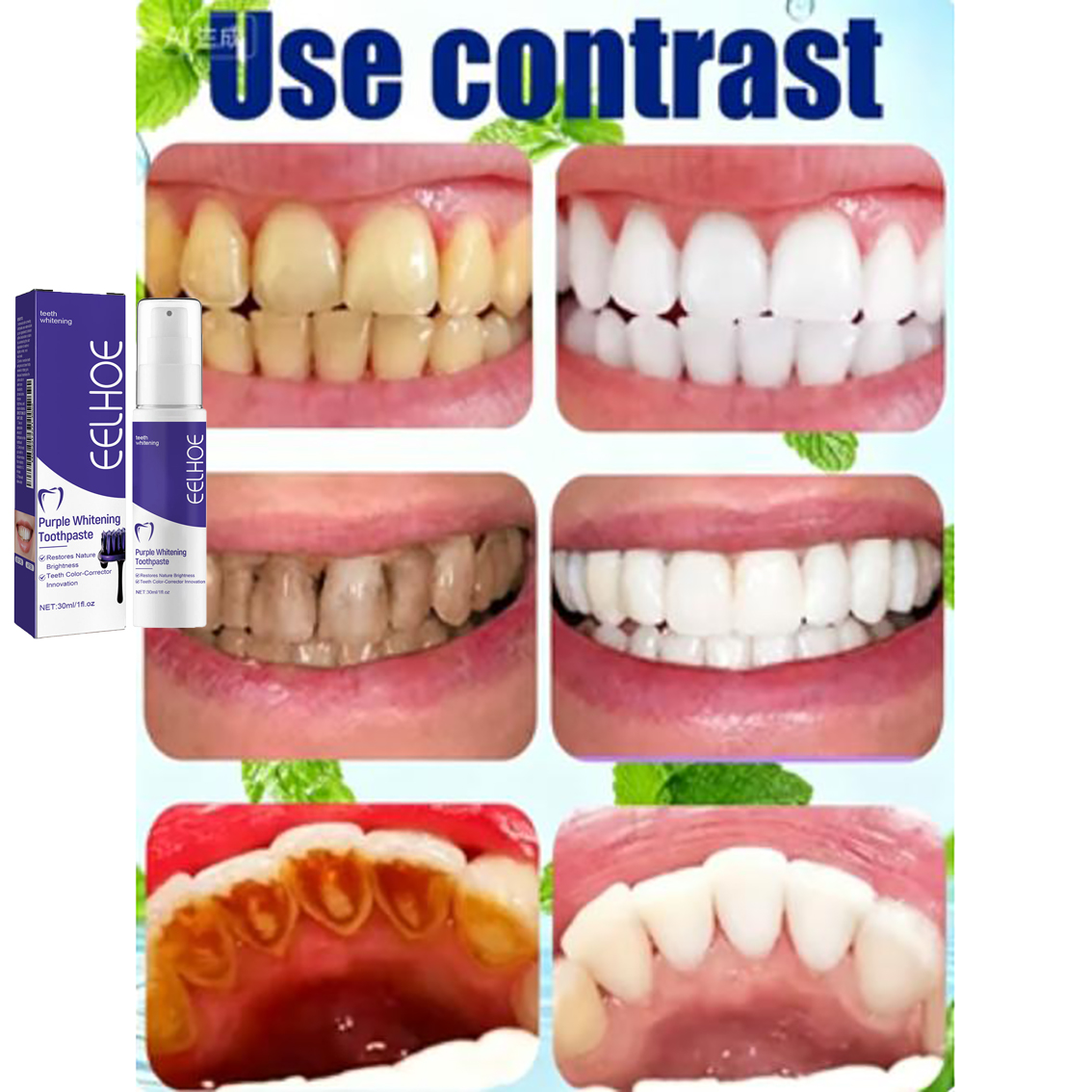 Teeth Cleansing Whitening Toot - огляд і ціна Teeth Whitening Korea