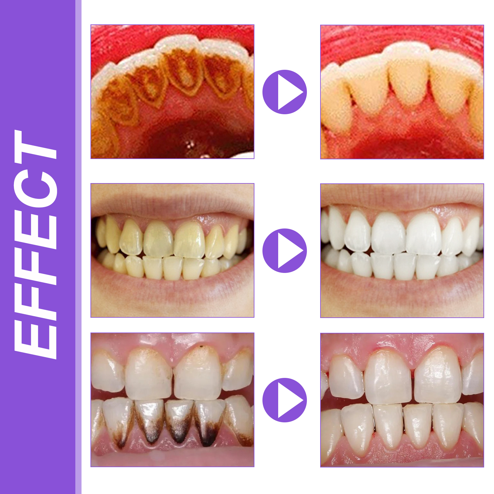 EELHOE Smiles Bright White Ref - огляд і ціна Teeth Whitening Foam