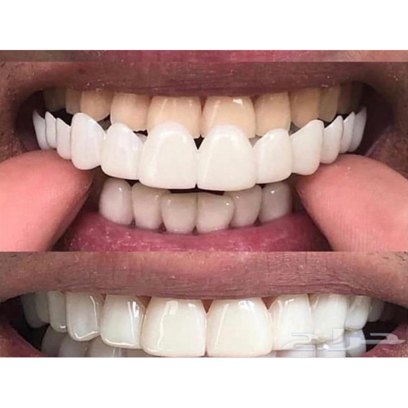 Graduation Photo Special Teeth - огляд і ціна Teeth Whitening For Photos
