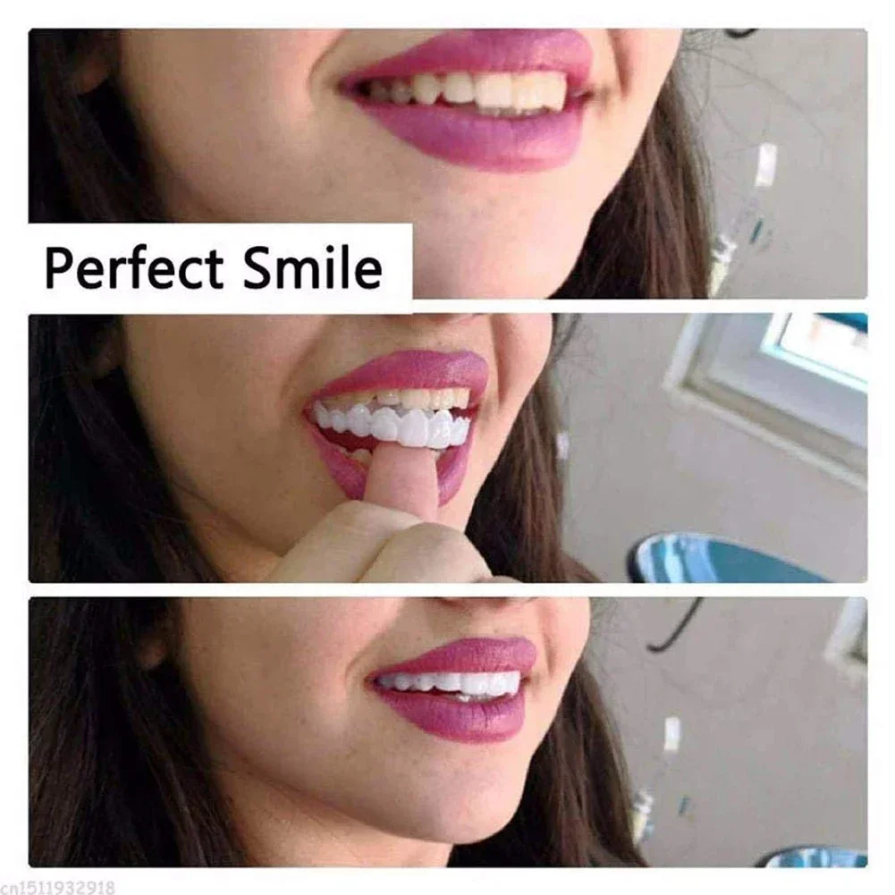 Pet Owner Teeth Veneers Reusab - огляд і ціна Teeth Whitening For Photos