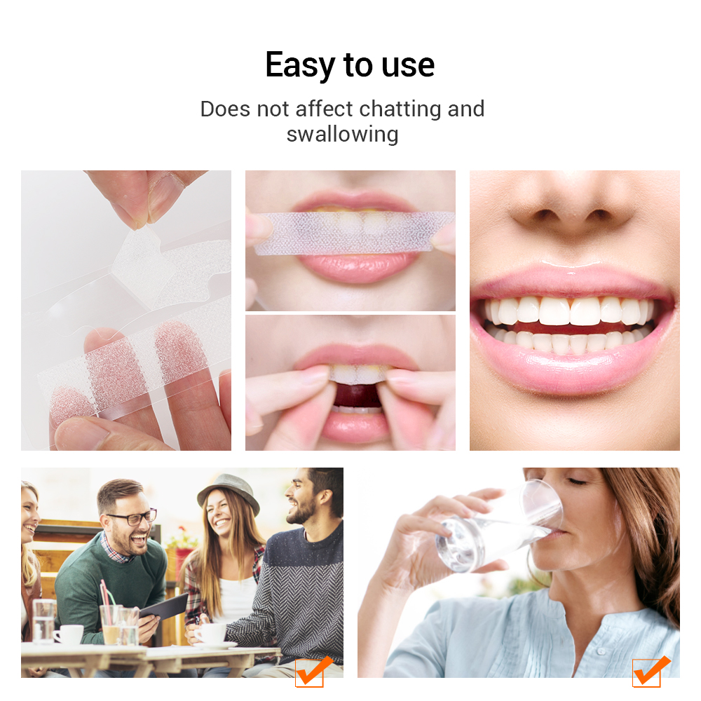 5D Teeth Whitening Strips Remo - огляд і ціна Teeth Whitening Yellow Teeth