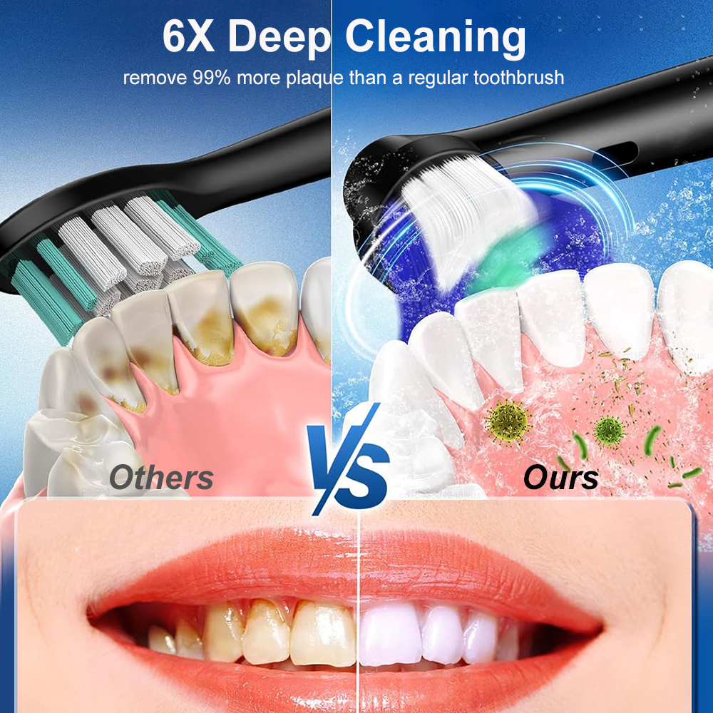 Electric Toothbrush Rotary Rec - огляд і ціна Teeth Whitening Toothbrush