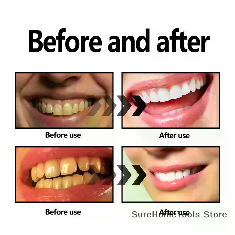 Bamboo Charcoal Powder For Tee - огляд і ціна Teeth Whitening Quotes