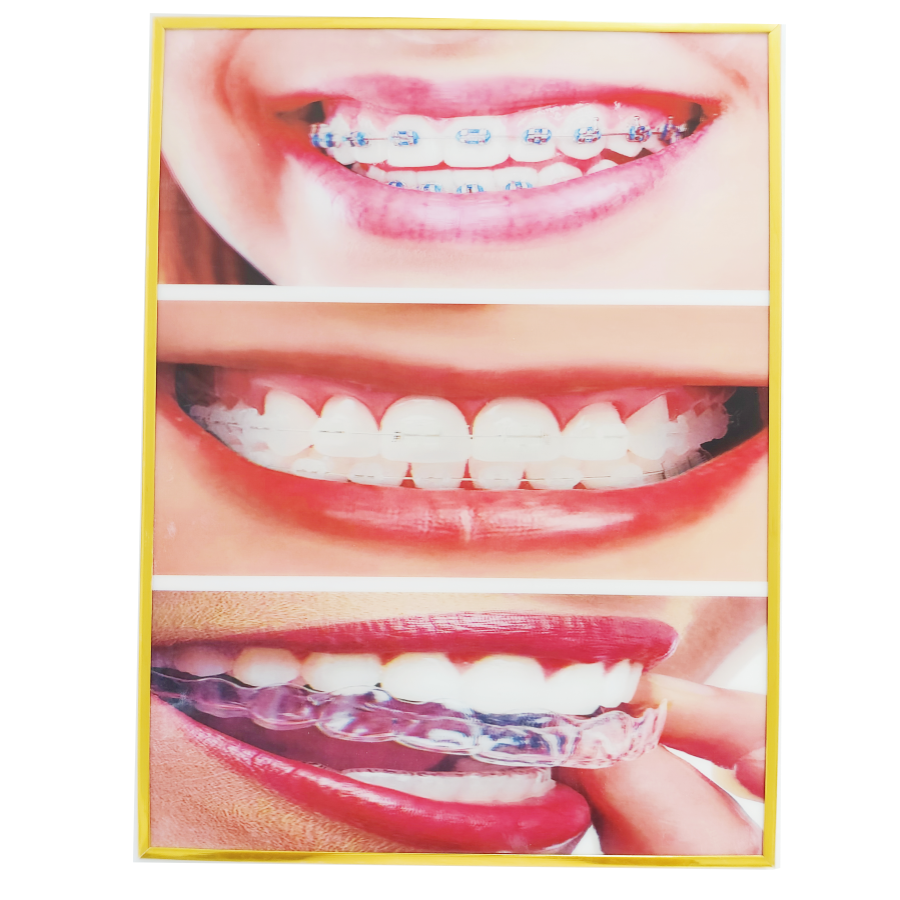 decorative 3D picture wall pho - огляд і ціна Teeth Whitening For Photos