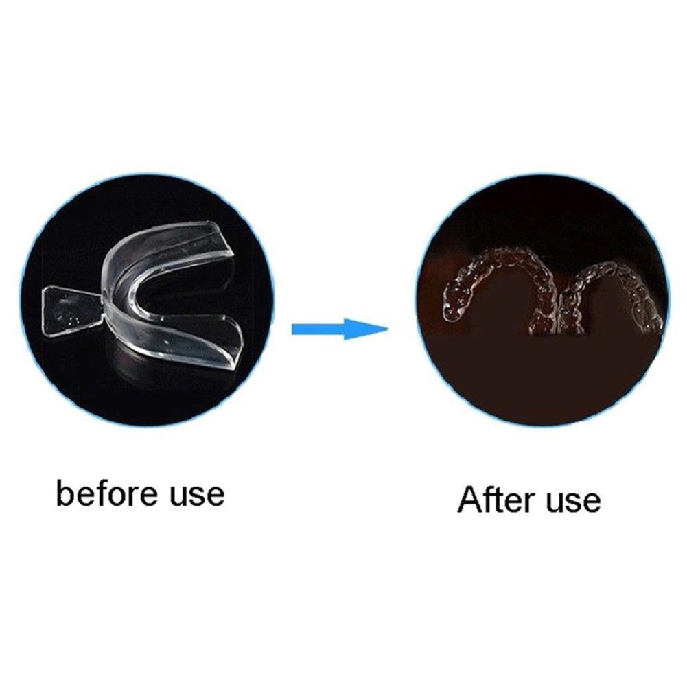 Silicone Mouth Guard Orthodont - огляд і ціна Teeth Whitening For Trays