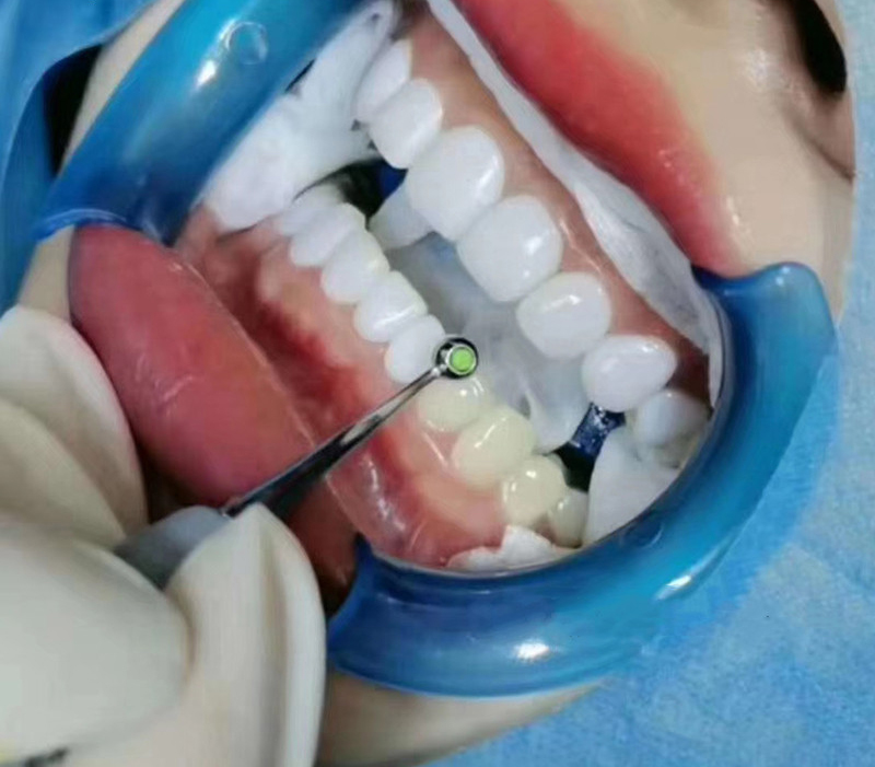 Dental Resin Filling Spatula D - огляд і ціна Teeth Whitening Foam Toothpaste