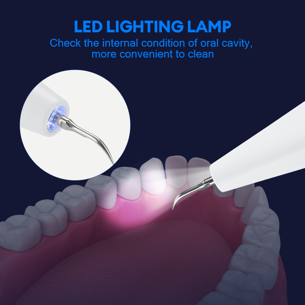Ultrasonic Dental Calculus Rem - огляд і ціна Teeth Whitening Home