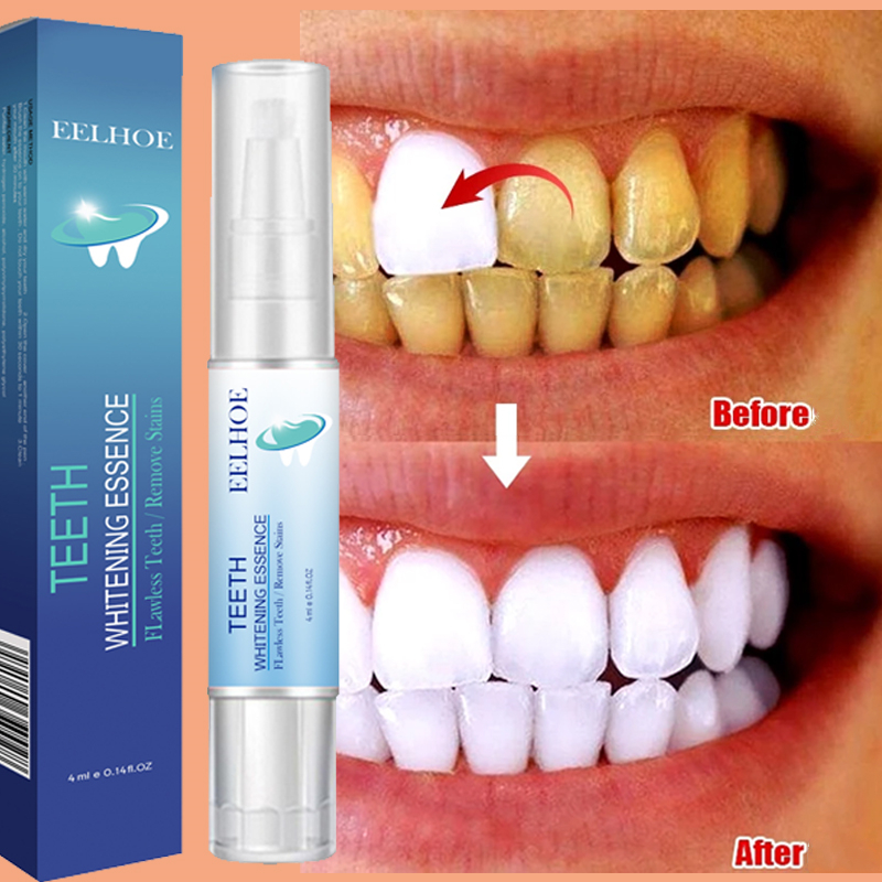 Teeth Whitening Pen Dental Ess - огляд і ціна Teeth Whitening Serum