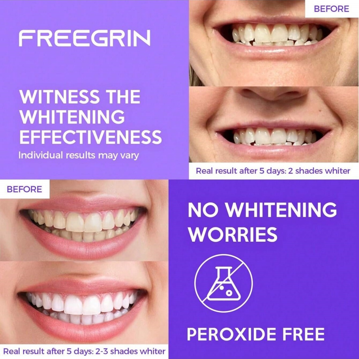 Deluxe Whitening Teeth Sticker - огляд і ціна Teeth Whitening Gel