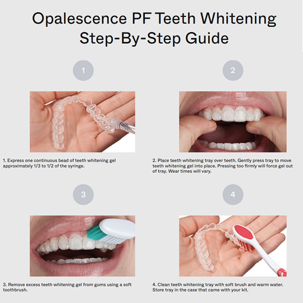 opalescence pf 15% refill kit  - огляд і ціна Teeth Whitening Gel Opalescence