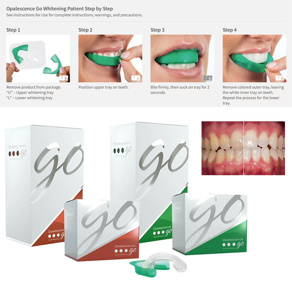Opalescence Go Teeth Whitening - огляд і ціна Teeth Whitening Gel Opalescence