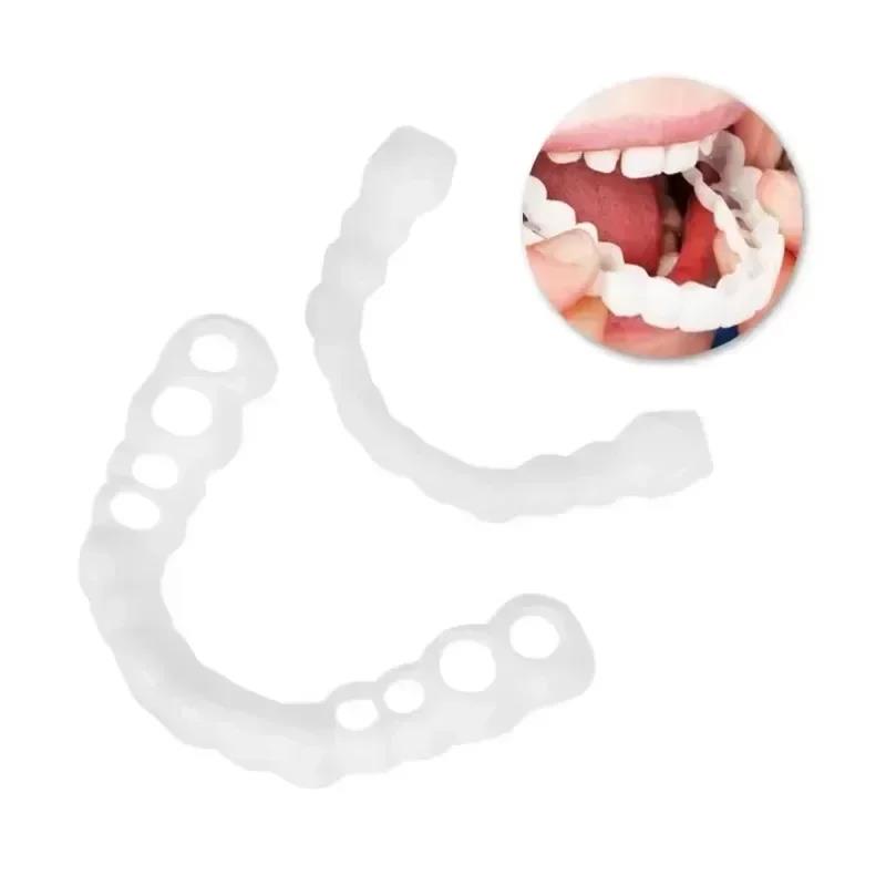 New Newlywed Couple Teeth Vene - огляд і ціна Teeth Whitening For Photos