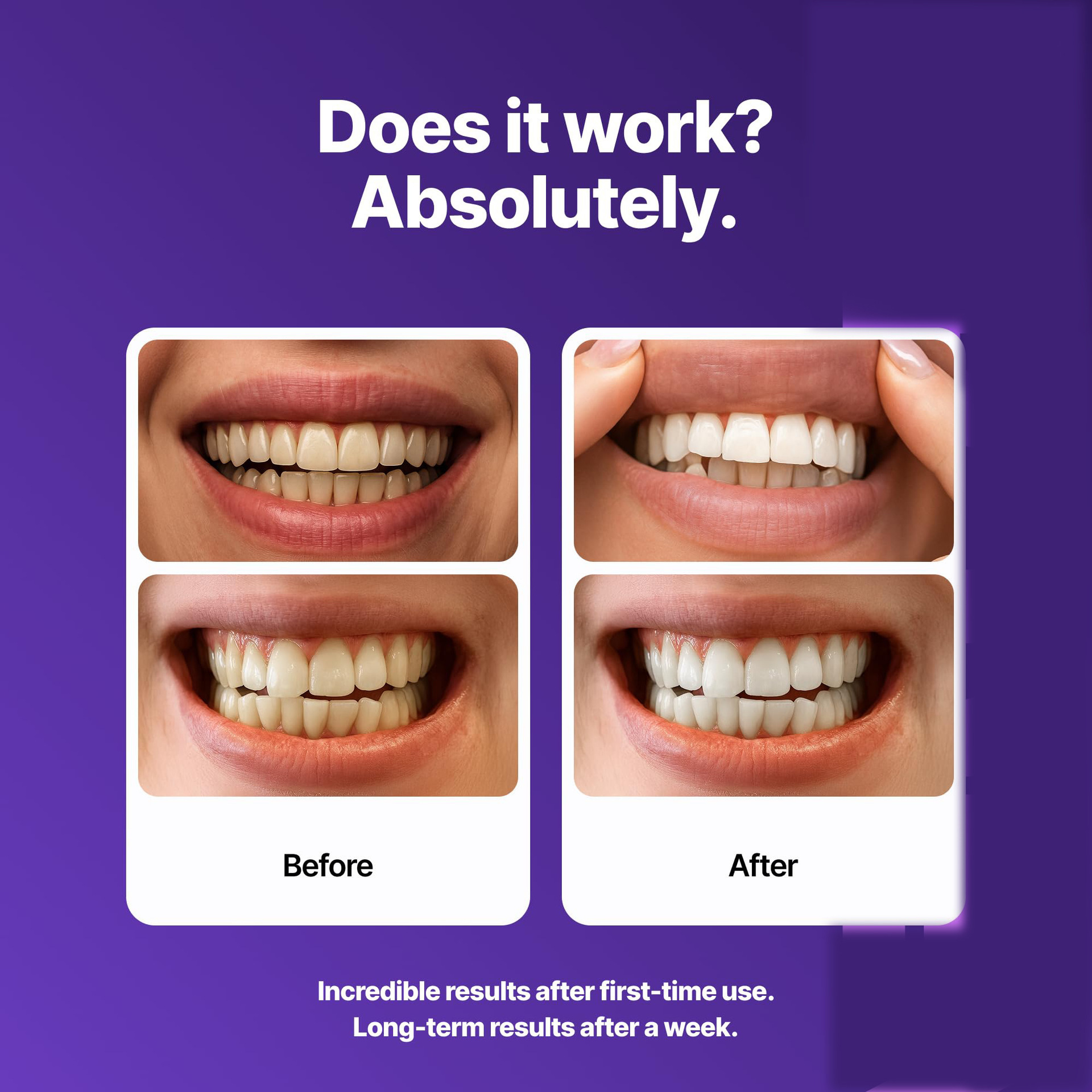 Purple Brightening Dental Patc - огляд і ціна Teeth Whitening Yellow Teeth