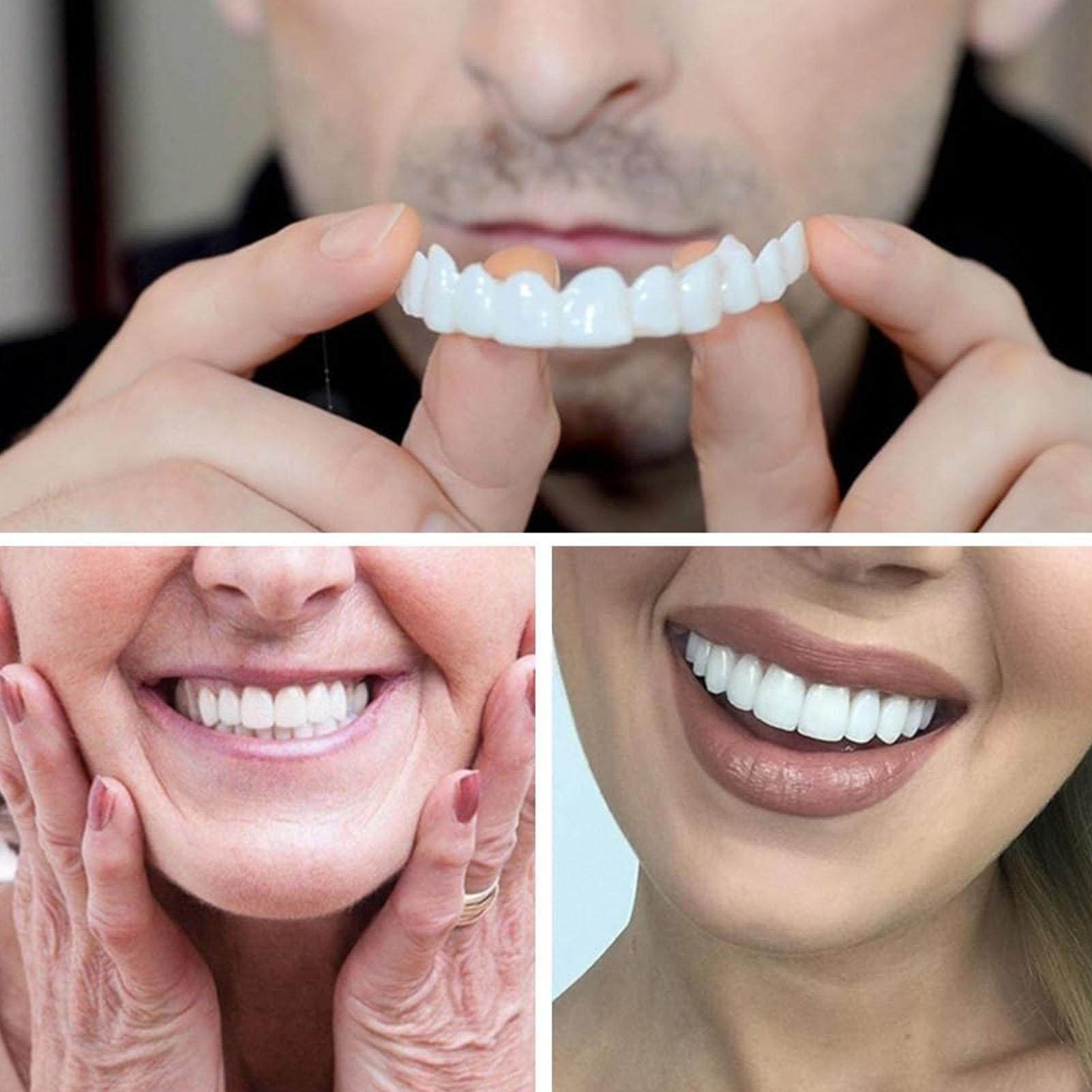 Camera Shy Person Teeth Veneer - огляд і ціна Teeth Whitening For Photos