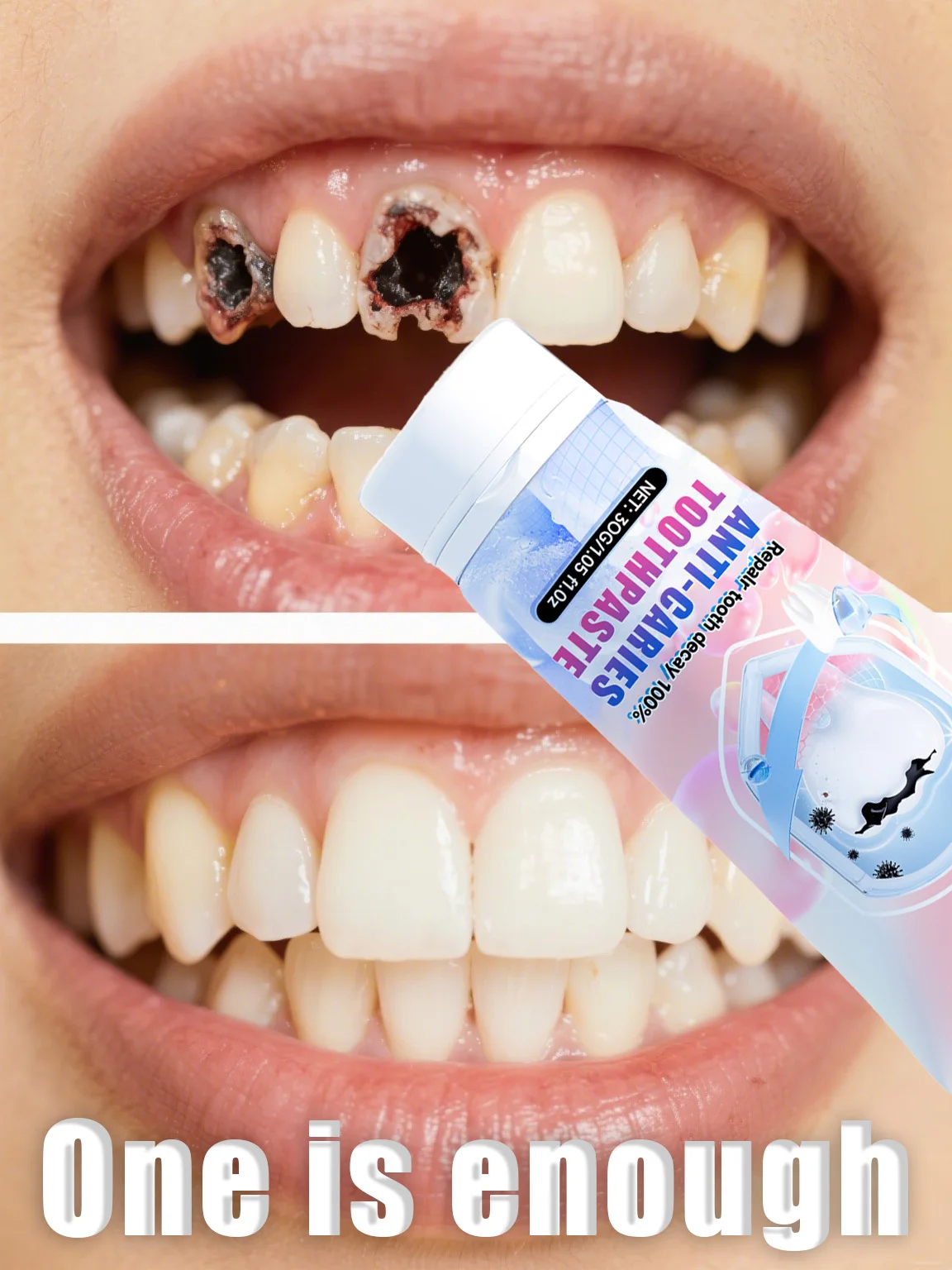 ⁹⁹% ᵒᶠ ᵖᵉᵒᵖˡᵉ ʳᵉᵖᵘʳᶜʰᵃˢᵉ ᵗᵒ ʳᵉ - огляд і ціна Teeth Whitening Foam