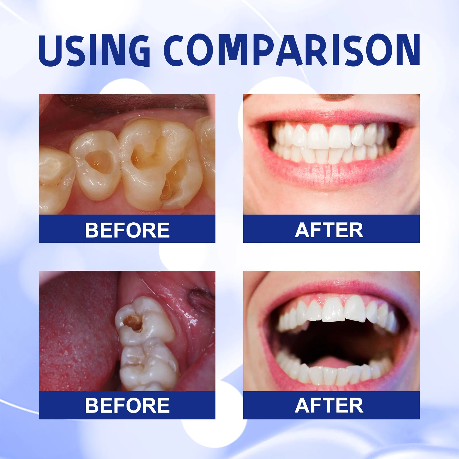 ⁹⁹% ᵒᶠ ᵖᵉᵒᵖˡᵉ ʳᵉᵖᵘʳᶜʰᵃˢᵉ ᵗᵒ ʳᵉ - огляд і ціна Teeth Whitening Foam