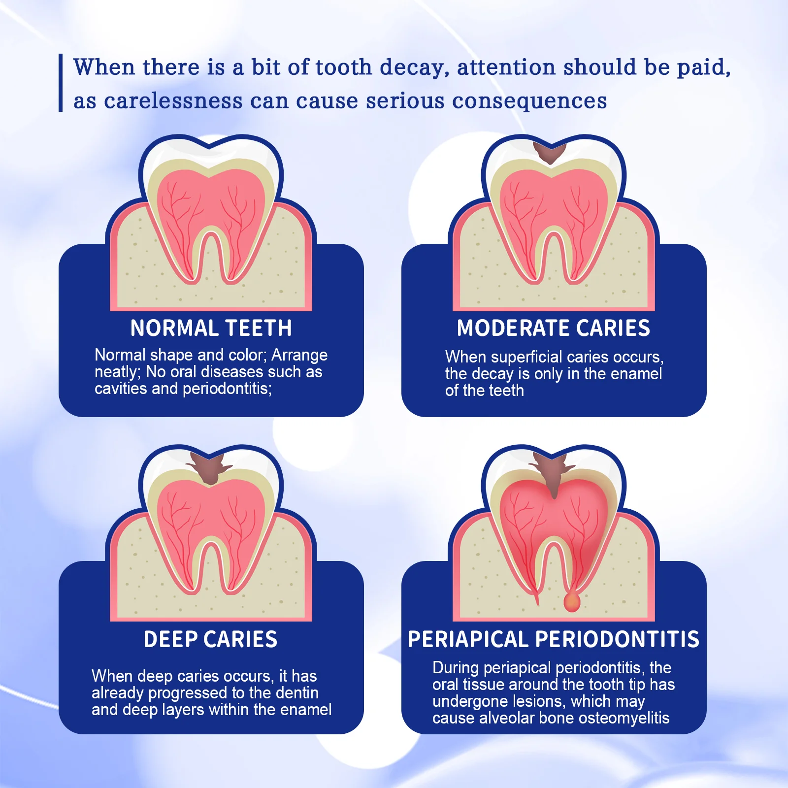⁹⁹% ᵒᶠ ᵖᵉᵒᵖˡᵉ ʳᵉᵖᵘʳᶜʰᵃˢᵉ ᵗᵒ ʳᵉ - огляд і ціна Teeth Whitening Foam