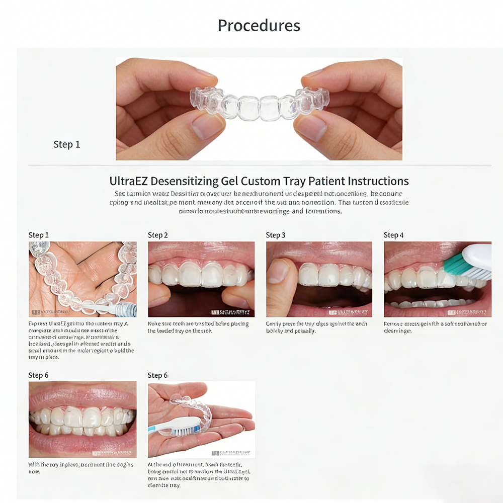 Ultra Ez Dental Desensitizing  - огляд і ціна Teeth Whitening Gel Opalescence