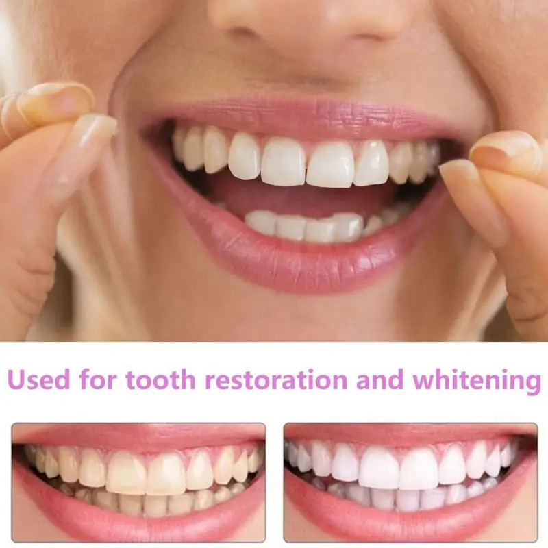 New Pet Owner Teeth Veneers Re - огляд і ціна Teeth Whitening For Photos