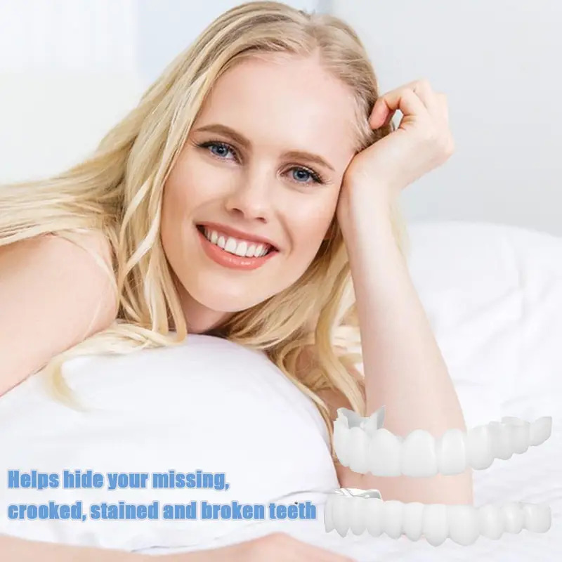 New Pet Owner Teeth Veneers Re - огляд і ціна Teeth Whitening For Photos