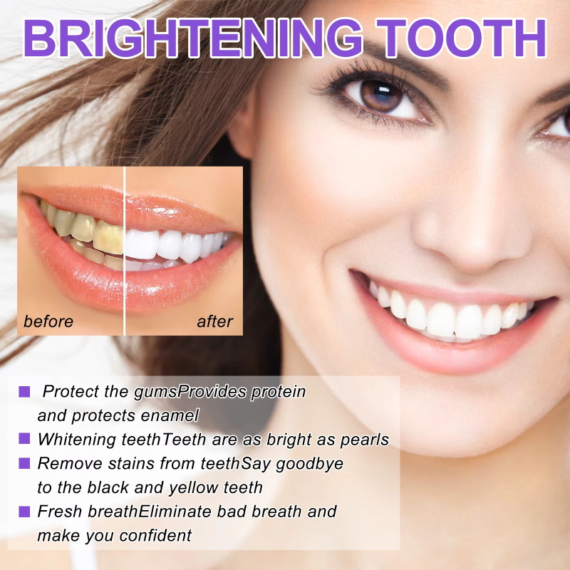 Teeth Cleansing Whitening Toot - огляд і ціна Teeth Whitening Korea