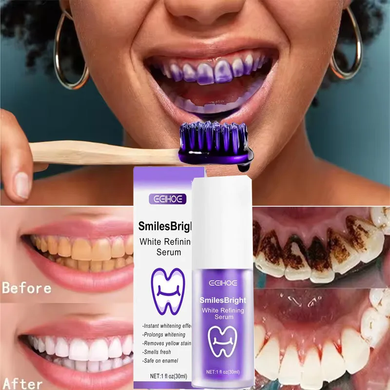 Whitening Toothpaste Teeth Cle - огляд і ціна Teeth Whitening Korea