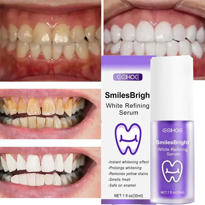 Whitening Toothpaste Teeth Cle - огляд і ціна Teeth Whitening Korea