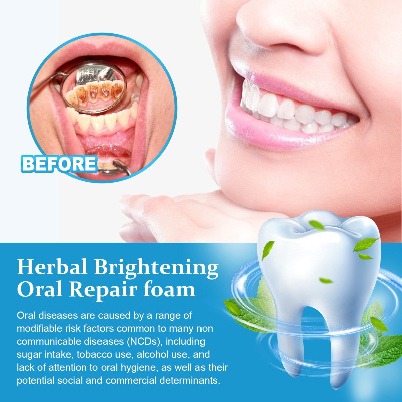 30ml Whitening Foam Mousse Too - огляд і ціна Teeth Whitening Foam Toothpaste