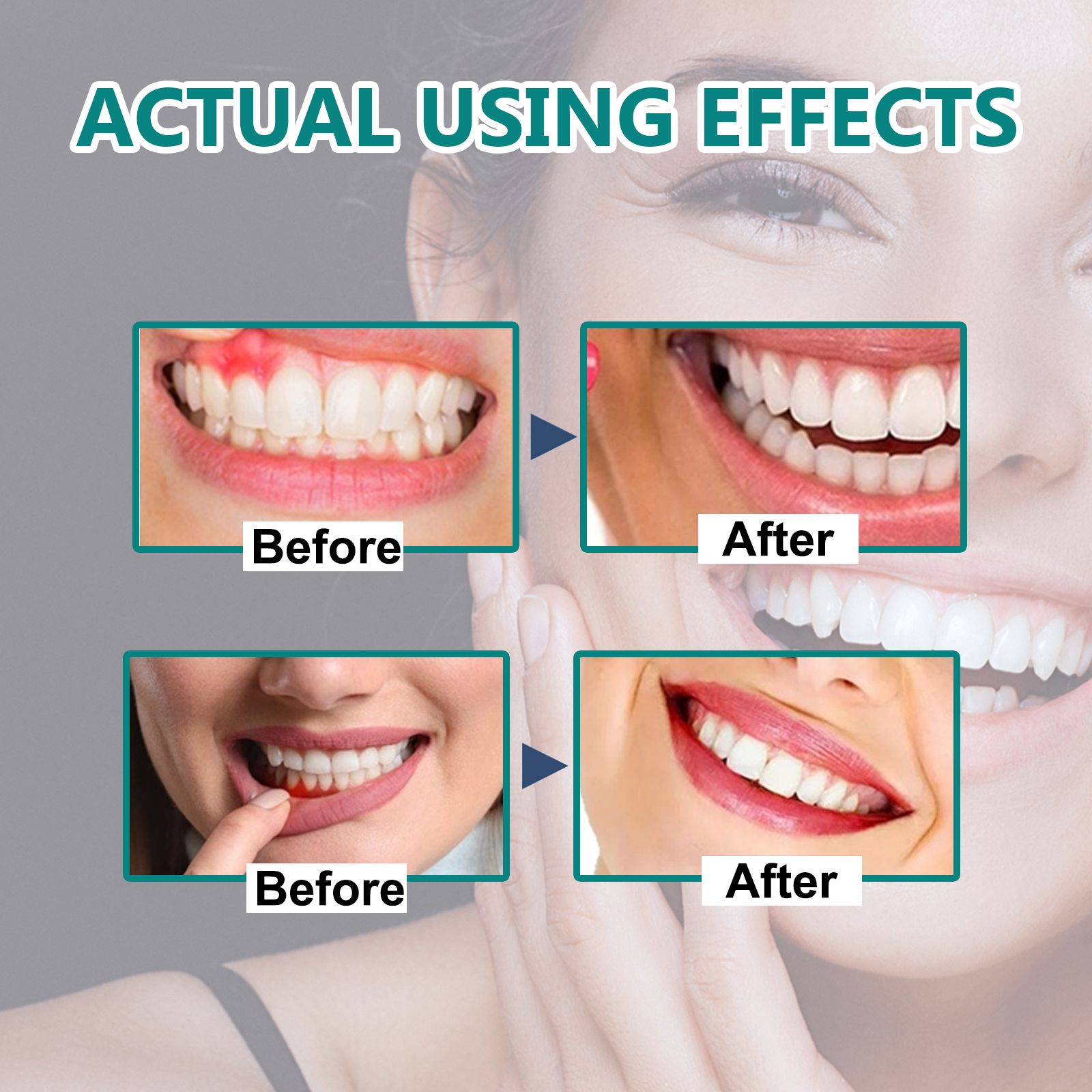 Gingival repair drops Quickly  - огляд і ціна Teeth Whitening Oil Pulling