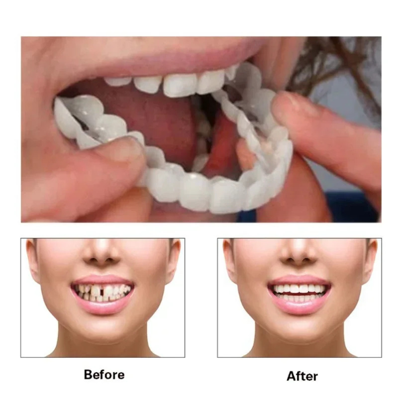 New Perfect Family Photo Smile - огляд і ціна Teeth Whitening For Photos