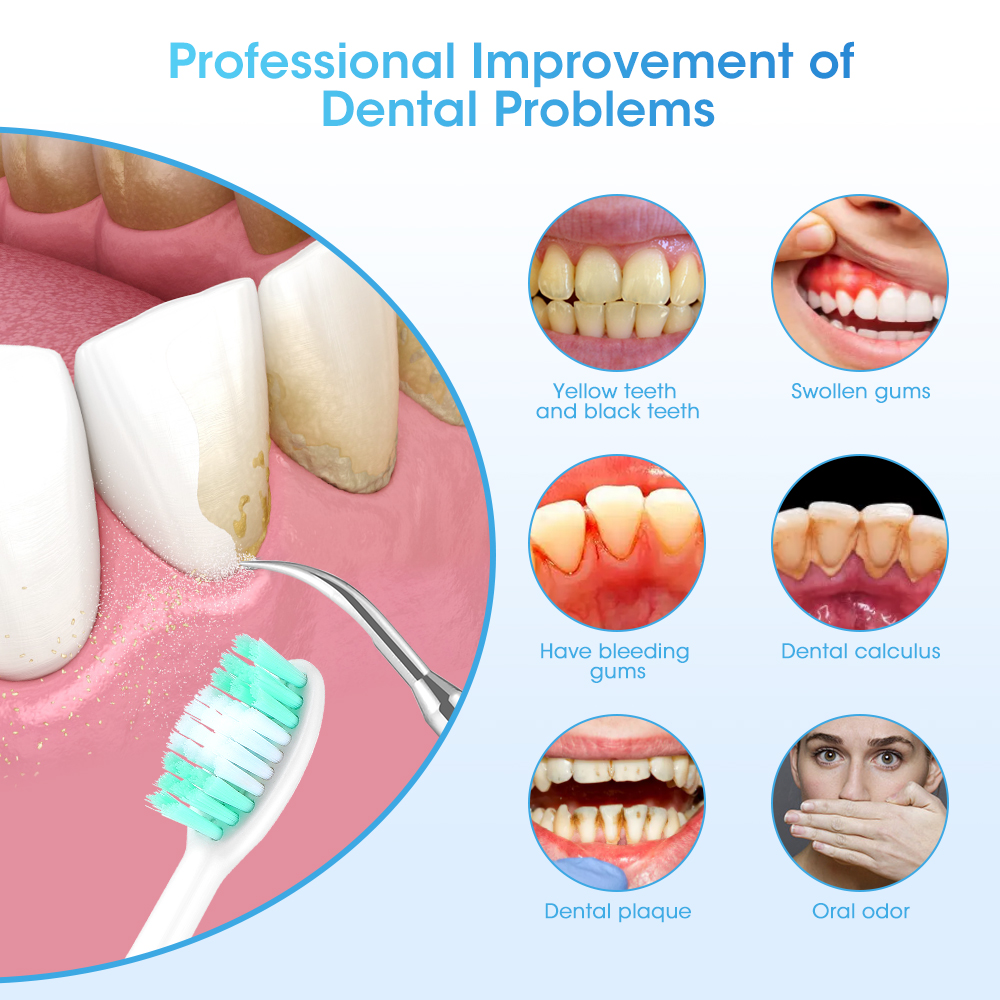 Electric Teeth Cleaner Sonic D - огляд і ціна Teeth Whitening Toothbrush
