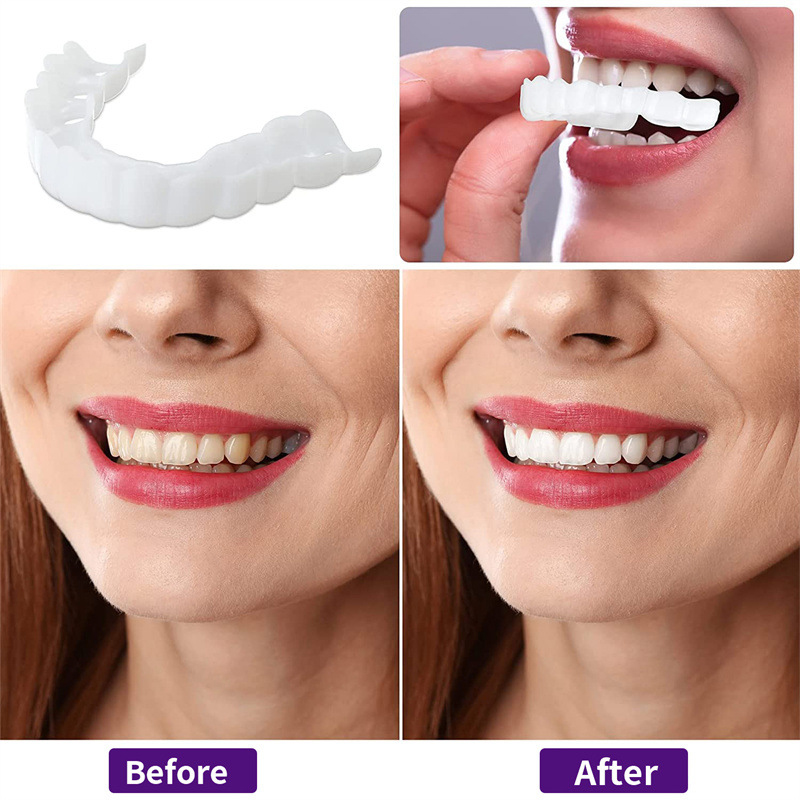 Holiday Travel Special Teeth V - огляд і ціна Teeth Whitening For Photos