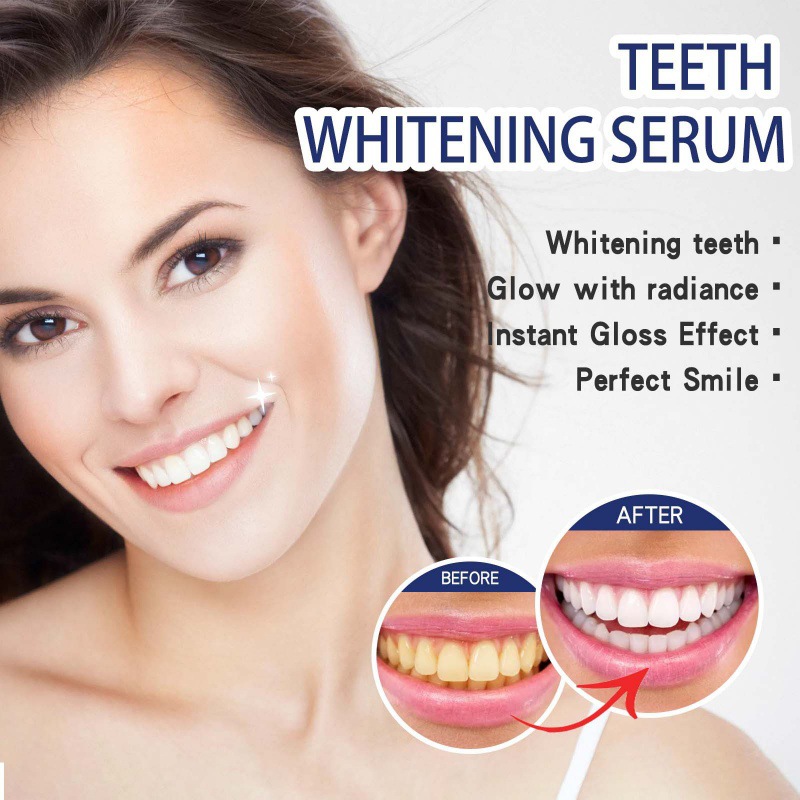 Professional Teeth Brightening - огляд і ціна Teeth Whitening Serum