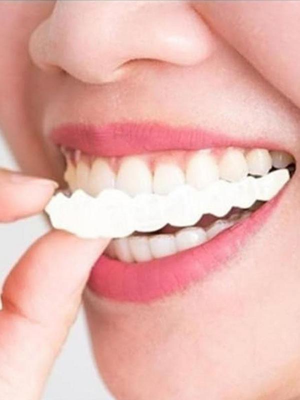 Pet Owner Teeth Veneers Reusab - огляд і ціна Teeth Whitening For Photos