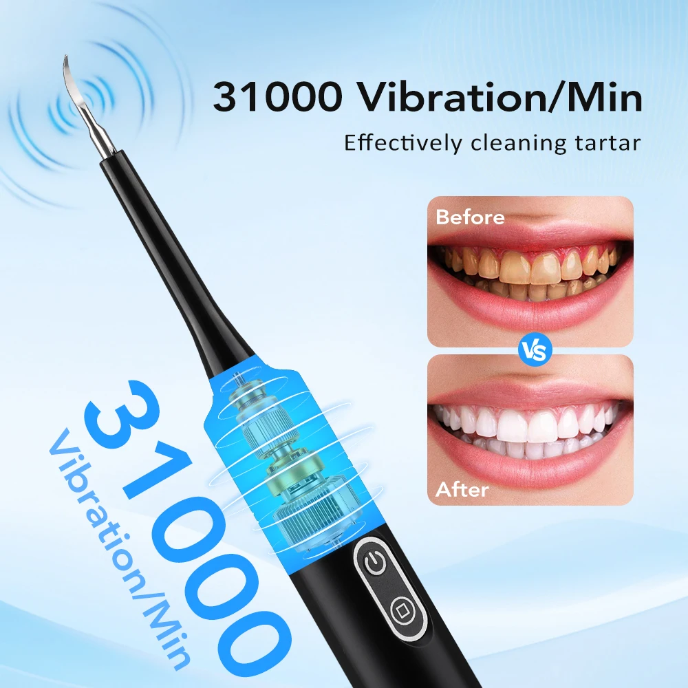 Electric Sonic Vibration Denta - огляд і ціна Teeth Whitening Toothbrush