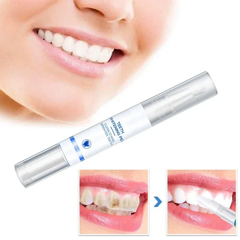 Teeth Whitening Pen Cleaning S - огляд і ціна Teeth Whitening Serum