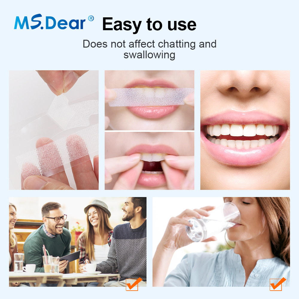 Teeth Whitening Strips Cleansi - огляд і ціна Teeth Whitening Gel